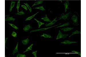 Immunofluorescence of monoclonal antibody to RCVRN on HeLa cell.