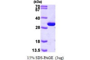 SDS-PAGE (SDS) image for phosphoglycerate Mutase 1 (Brain) (PGAM1) (AA 1-254) protein (His tag) (ABIN667196)