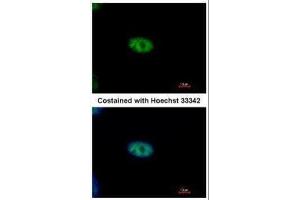 ICC/IF Image Immunofluorescence analysis of paraformaldehyde-fixed A549, using NYREN18, antibody at 1:500 dilution.