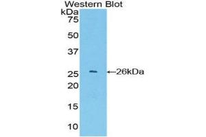 Western Blotting (WB) image for anti-Glutathione S-Transferase alpha 4 (GSTA4) (AA 1-222) antibody (ABIN1078080) (GSTA4 anticorps  (AA 1-222))
