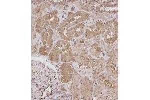 Immunohistochemical analysis of (ABIN392043 and ABIN2841811) on paraffin-embedded Human kidney tissue. (ROR1 anticorps)