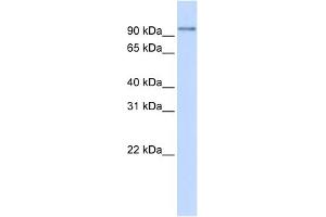 WB Suggested Anti-PDXDC1 Antibody Titration: 0. (PDXDC1 anticorps  (N-Term))