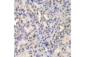 Immunohistochemistry of paraffin-embedded rat kidney using DDX41 antibody. (DDX41 anticorps  (AA 1-300))
