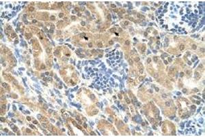Immunohistochemical staining (Formalin-fixed paraffin-embedded sections) of human kidney with IHH polyclonal antibody  at 4-8 ug/mL working concentration. (Indian Hedgehog anticorps  (N-Term))