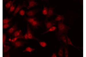 ABIN6267602 staining HeLa by IF/ICC.