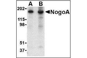 Image no. 2 for anti-Reticulon 4 (RTN4) (N-Term) antibody (ABIN372912)