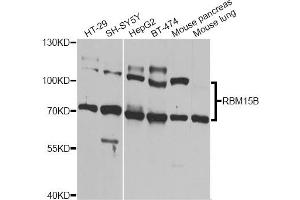 Western blot analysis of extracts of various cell lines, using RBM15B Antibody.