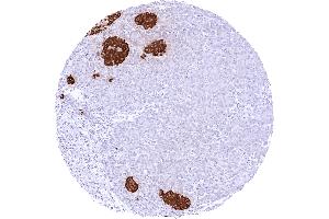 Pancreas with a strong cytoplasmic insulin staining of the majority of islet cells (Recombinant Insulin anticorps)