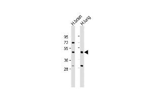 All lanes : Anti-IFT57 Antibody (Center) at 1:2000 dilution Lane 1: Human brain lysate Lane 2: Human lung lysate Lysates/proteins at 20 μg per lane. (IFT57 anticorps  (AA 159-193))
