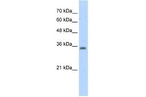 WB Suggested Anti-RASSF7 Antibody Titration:  5.