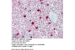 anti-One Cut Homeobox 1 (ONECUT1) (Middle Region) antibody