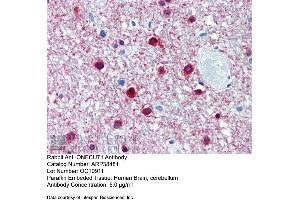 Immunohistochemistry with Human Brain, cerebellum tissue at an antibody concentration of 5. (ONECUT1 anticorps  (Middle Region))