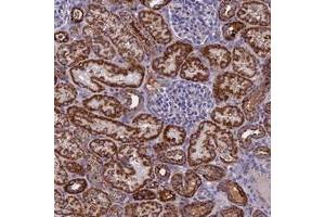 Immunohistochemical staining of human kidney with NDUFB9 polyclonal antibody  shows strong cytoplasmic positivity in cells in tubules at 1:20-1:50 dilution.