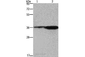 Western blot analysis of 293T cell and mouse brain tissue, using FCAR Polyclonal Antibody at dilution of 1:550 (FCAR anticorps)