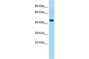 Host:  Rabbit  Target Name:  Gdap1l1  Sample Type:  Rat Kidney lysates  Antibody Dilution:  1. (GDAP1L1 anticorps  (C-Term))