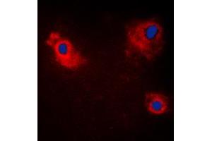Immunofluorescent analysis of TANK staining in HeLa cells. (TANK anticorps  (Center))