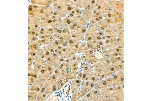 Immunohistochemistry of paraffin embedded mouse pancreatic using CITED4 (ABIN7073356) at dilution of 1:2200 (400x lens)