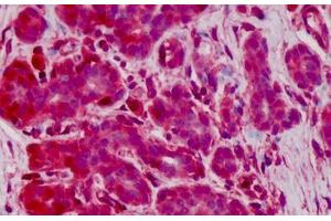 Human Breast: Formalin-Fixed, Paraffin-Embedded (FFPE)