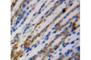 IHC-P analysis of kidney tissue, with DAB staining. (SPRY2 anticorps  (AA 116-305))