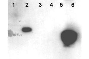 Western blot using  Affinity Purified anti-HMNG antibody shows detection of phosphorylated HMGN1 and HMGN2.