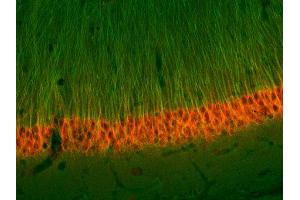 Immunohistochemistry (IHC) image for anti-alpha Tubulin (TUBA1) (AA 443-449) antibody (ABIN1742550)