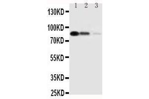 Lane 3: Recombinant Human CD163 Protein 2.