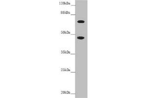 Western blot All lanes: SLC39A4 antibody at 4.