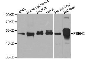 Western blot analysis of extracts of various cell lines, using PSEN2 antibody. (Presenilin 2 anticorps)