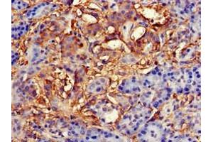 Immunohistochemistry of paraffin-embedded human pancreatic tissue using ABIN7145827 at dilution of 1:100 (TNFAIP1 anticorps  (AA 233-316))