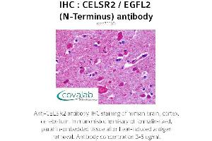 Image no. 2 for anti-Cadherin EGF LAG Seven Pass G-Type Receptor 2 (CELSR2) (Extracellular Domain), (N-Term) antibody (ABIN1732970) (CELSR2 anticorps  (Extracellular Domain, N-Term))
