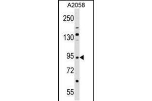 Western blot analysis in A2058 cell line lysates (35ug/lane). (TRIM42 anticorps  (AA 441-470))