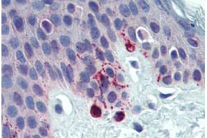 Skin, Human: Formalin-Fixed, Paraffin-Embedded (FFPE)