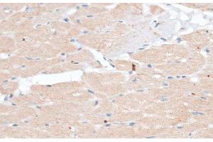 Immunohistochemistry of paraffin-embedded Rat heart using ABCB7 Polyclonal Antibody at dilution of 1:100 (40x lens). (ABCB7 anticorps)