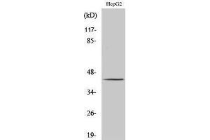 Western Blotting (WB) image for anti-Proteasome (Prosome, Macropain) 26S Subunit, ATPase, 6 (PSMC6) (Internal Region) antibody (ABIN3186583)