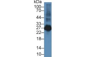 Western Blot; Sample: Rat Spleen lysate; Primary Ab: 2µg/ml Rabbit Anti-Rat LAT2 Antibody Second Ab: 0. (LAT2 anticorps  (AA 32-192))