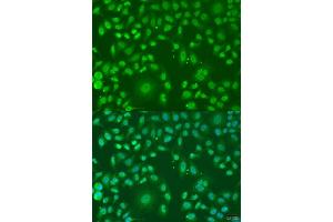 anti-ADP Ribosylation Factor Like GTPase 6 (ARL6) (AA 1-186) antibody