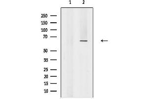 anti-Eukaryotic Translation Initiation Factor 3, Subunit D (EIF3D) (Internal Region) antibody
