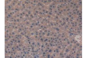 Detection of MEP1b in Rat Liver Tissue using Polyclonal Antibody to Meprin A Beta (MEP1b) (Meprin B anticorps  (AA 433-679))