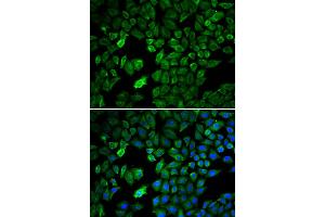 Immunofluorescence analysis of U2OS cells using PRMT5 antibody. (PRMT5 anticorps)