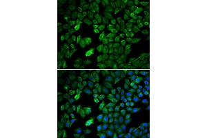 Immunofluorescence analysis of U2OS cells using PRMT5 antibody. (PRMT5 anticorps)