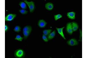 Immunofluorescence staining of A549 cells with ABIN7169172 at 1:50, counter-stained with DAPI. (Sbk2 anticorps  (AA 62-330))