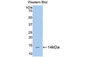 Western Blotting (WB) image for anti-Carcinoembryonic Antigen-Related Cell Adhesion Molecule 1 (CEACAM1) (AA 35-143) antibody (ABIN1175886) (CEACAM1 anticorps  (AA 35-143))
