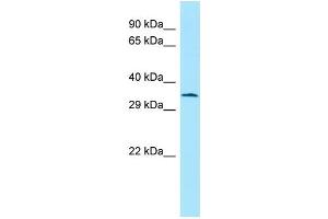 WB Suggested Anti-Atf5 Antibody Titration: 1. (ATF5 anticorps  (C-Term))