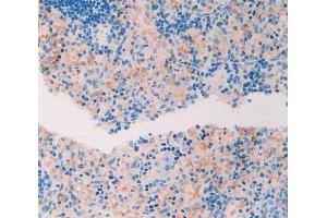 Used in DAB staining on fromalin fixed paraffin- embedded spleen tissue (ADAMTS1 anticorps  (AA 476-614))