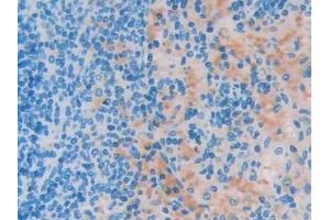 Detection of UCP2 in Rat Spleen Tissue using Polyclonal Antibody to Mitochondrial Uncoupling Protein 2 (UCP2)