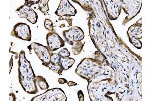 IHC analysis of KIF2A using anti-KIF2A antibody (ABIN7600510). (KIF2A anticorps  (AA 2-706))
