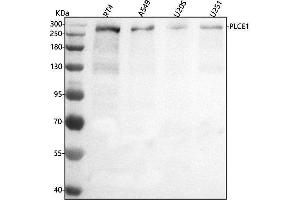 anti-Phospholipase C, epsilon 1 (PLCE1) (AA 4-735) antibody