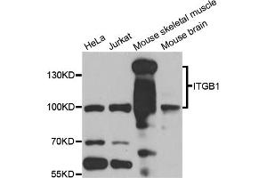 Western blot analysis of extracts of various cell lines, using ITGB1 antibody (ABIN6003513) at 1/1000 dilution. (ITGB1 anticorps)