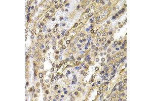 Immunohistochemistry (IHC) image for anti-Neural Precursor Cell Expressed, Developmentally Down-Regulated 9 (NEDD9) (AA 60-174) antibody (ABIN6219606) (NEDD9 anticorps  (AA 60-174))