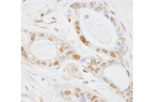 Immunohistochemistry (IHC) image for anti-Pseudouridylate Synthase 1 (PUS1) (AA 377-427) antibody (ABIN7448747)